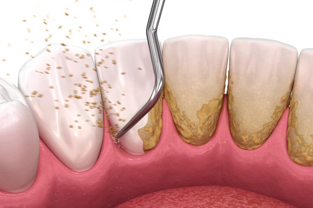 dentist in hb town pardi