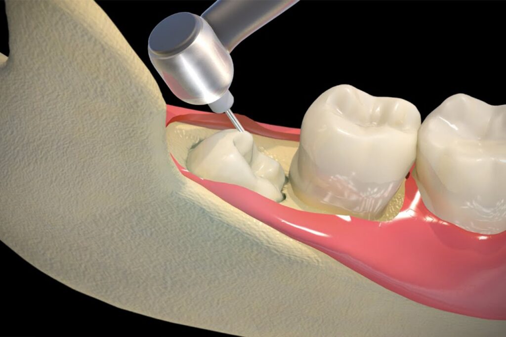 dentist in hb town pardi