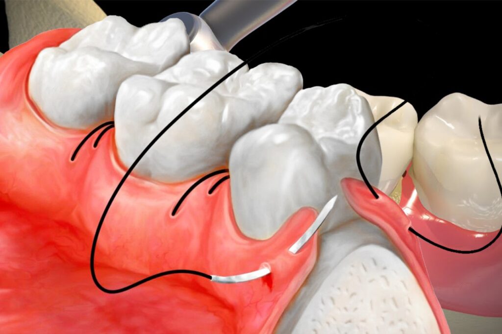 dentist in hb town pardi