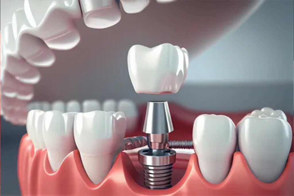 dental clinic in nagpur